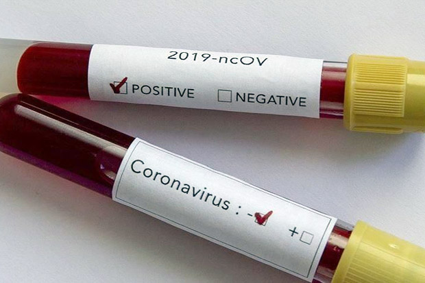 Dua Negara Afrika Konfirmasi Kasus Virus Corona Pertama