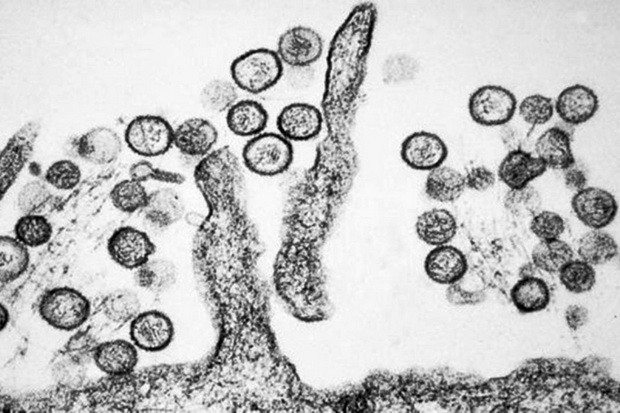 Bukan Virus Baru, Hantavirus Ditemukan Sejak Perang Korea