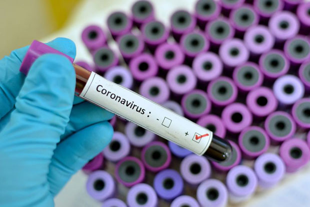 Cari Antibiotik Corona, Gabungan Ilmuwan Mengarah Kepenggunaan Ganja