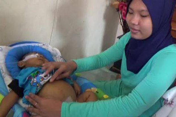 Derita Atresia Bilier, Bayi 7 Bulan Asal Kuningan Butuh Bantuan Dermawan