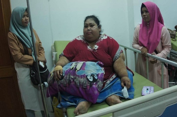 2 Tahun Ditinggal Suami, Sunarti Derita Obesitas 148 Kg