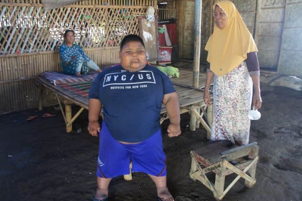 Cellica Perintahkan Dinkes Karawang Bantu Pengobatan Satia Bocah Penderita Obesitas