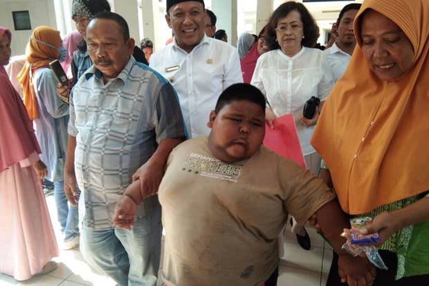 Keluarga Tak Setuju Satia Bocah Obesitas Dioperasi