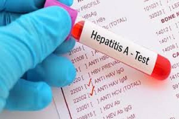 Puluhan Siswa SMPN 20 Depok Terjangkit Virus Hepatitis A