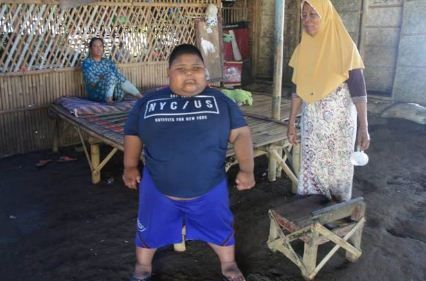 Umur Baru 7 Tahun, Bocah Ini Beratnya Capai 101 Kilogram