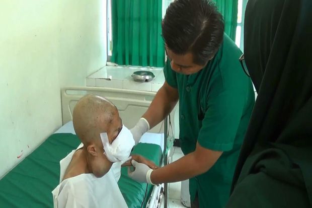 Janda Dua Anak Penderita Kanker Rongga Mulut Butuh Bantuan