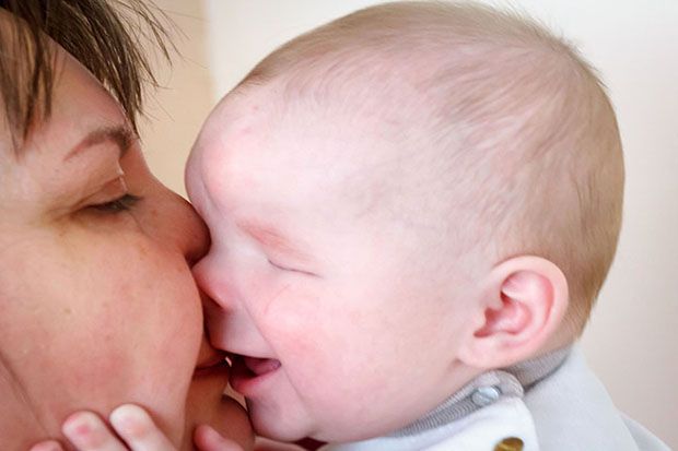Bayi di Rusia Lahir Tanpa Mata Tapi Bibir Terus Tersenyum