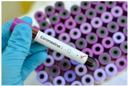 Lab Pemeriksaan Covid-19 di RS UNS Ditargetkan Mulai Pekan Depan