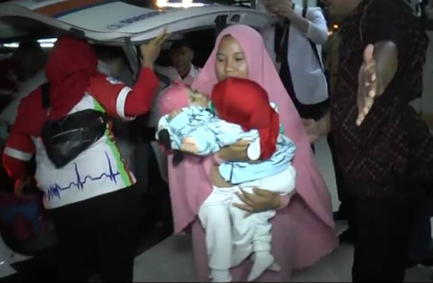 Lima Jam Operasi Menegangkan, Bayi Kembar Siam Berhasil Dipisahkan