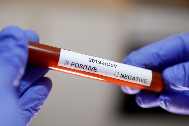 RS Tulungagung Ajukan Diri Bisa Lakukan Tes PCR Corona Sendiri