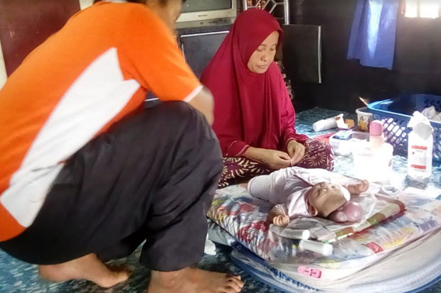 Bayi 4 Bulan di Kabupaten Pinrang Lahir Tanpa Batok Kepala