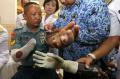 Pengguna Bionic Hand Pertama di Indonesia